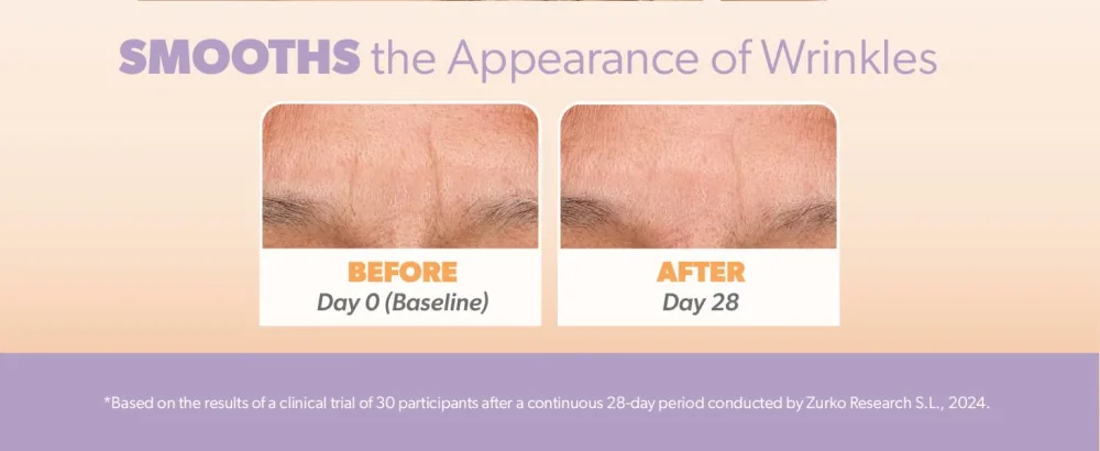Smoothies Full Coverage Wrinkle Patches for Face Overnight - Facial Patches for Forehead Elevens Crows Feet and more - Full Coverage - 192 Facial Adhesives per Box - Boxes showing before and after examples.