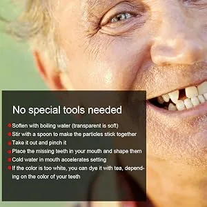 Temporary Tooth Repair Beads, For Missing Dental Filling Material With Broken Teeth, Cosmetic Teeth Whiten Teeth Temporary Tooth Repair For Snap Lid Missing(F2) - Temporary Tooth Repair Beads