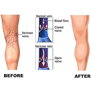 Copper Compression Socks for Women & Men Open Toe 20-30mmHg is Best Support for Circulation Recovery and All Day Wear 01 Black Large-X-Large - product information 6