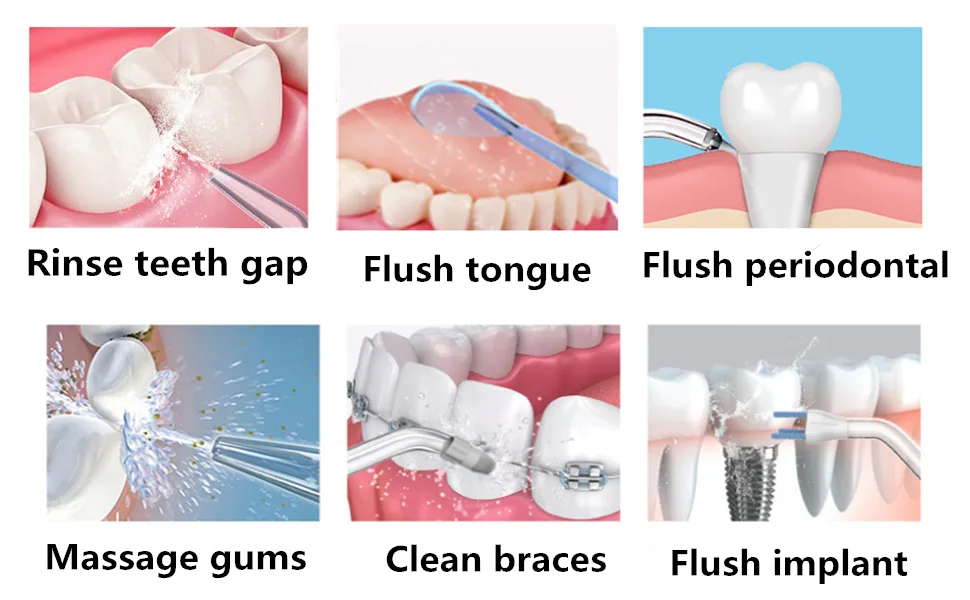 WuYan Water Flosser for Teeth, Replacement Tooth Cleaner Dental Floss Fittings for Water Wp-100 Wp-450 Wp-660 Wp-900 - product information 6
