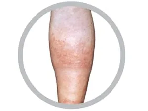 Mojo Compression Socks Unisex Wide Calf Compression Socks, Plus Size Compression Socks (20-30mmHg) for Varicose Veins, Wide Calves - Compression Stockings, 7 Colors, 10 Sizes 4X-Large Black - deep veind thrombosis treatment compression sotkcings plus size wide calf
