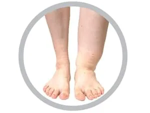 Mojo Compression Socks Unisex Wide Calf Compression Socks, Plus Size Compression Socks (20-30mmHg) for Varicose Veins, Wide Calves - Compression Stockings, 7 Colors, 10 Sizes 4X-Large Black - lyphedema in the legs compression socks stockings swelling