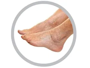 Mojo Compression Socks Unisex Wide Calf Compression Socks, Plus Size Compression Socks (20-30mmHg) for Varicose Veins, Wide Calves - Compression Stockings, 7 Colors, 10 Sizes 4X-Large Black - poor circulation compression socks and stocking increase blood flow