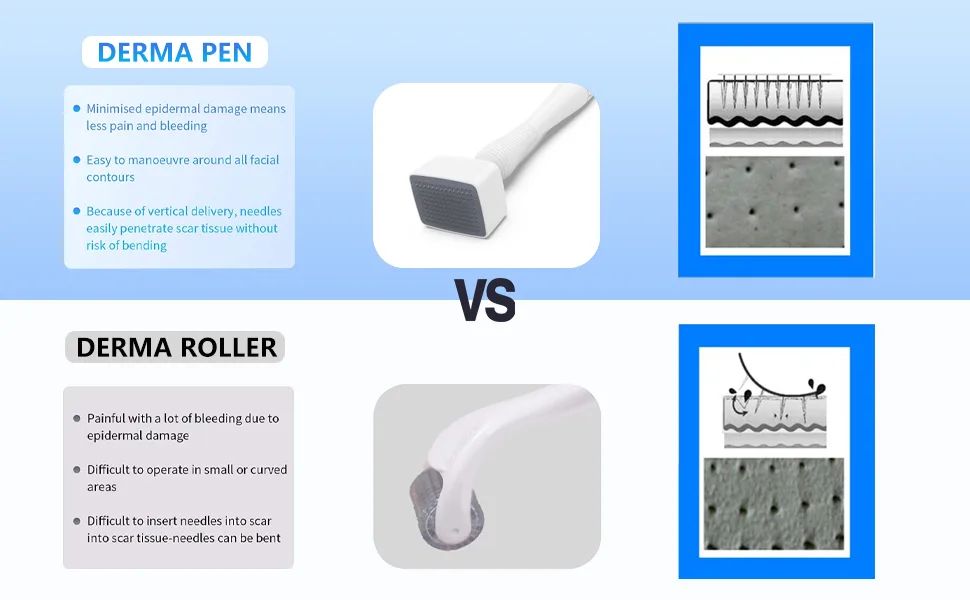 INCELLICE Adjustable Derma Stamp 140 Professional Individual Microneedling Pen for Face Body Hair Beard Growth Home Use Milky-Basic Stamp - product information 2