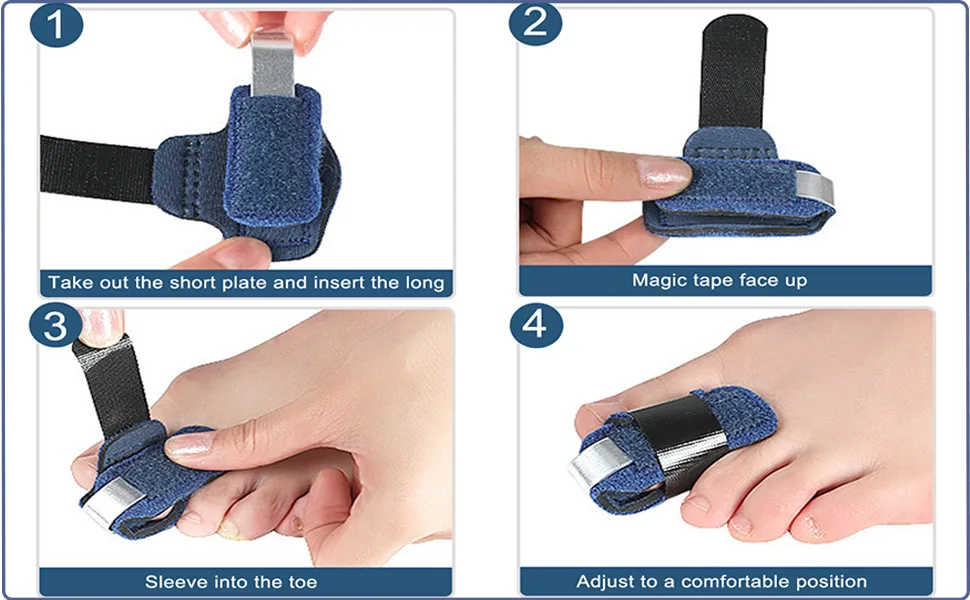 1 Pair Toe Splint for Broken Toe, Hammer Toe Straightener Toe Corrector, Toe Brace for Big Toe, Curled Toe, Women Men Broken Toe to Align and Support Toe Wraps, Extended Adjustable Strap - 1 Pair Toe Splint Broken Toe Brace