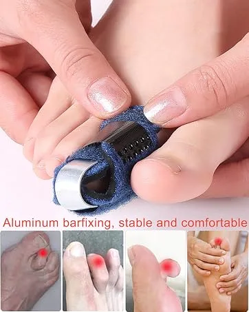 1 Pair Toe Splint for Broken Toe, Hammer Toe Straightener Toe Corrector, Toe Brace for Big Toe, Curled Toe, Women Men Broken Toe to Align and Support Toe Wraps, Extended Adjustable Strap - 1 Pair Toe Splint Broken Toe Brace