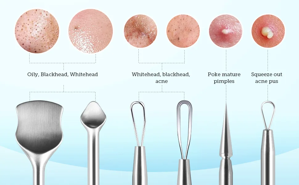 LitBear Pore Prep Tool, Blackhead Remover Pimple Popper Tool Kit, Stainless Steel Blackhead Extractions Tool for Acne, Whitehead Popping, Blemish, Comedone - whitehead remove tool
