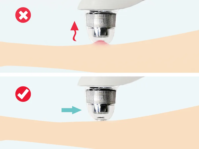 2023 Newest Blackhead Remover Face Pore Vacuum Cleaner EZBASICS Blackhead Vacuum Rechargeable White Heads Removal with 3 Adjustable Suction Power Blackhead Extractor Tool with LED Display (White) - Blackhead Remover
