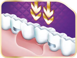 Corega Max fixation + seal fixing cream for dental prostheses up to 12 hours fixation 70 g Maximum sealing cream 70 g - Corega
