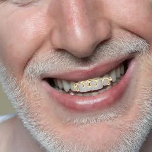 HAPINARY Hip Hop Teardrop Drip Teeth Caps Gold Plated Teeth Caps for Event Costumes - product information 2