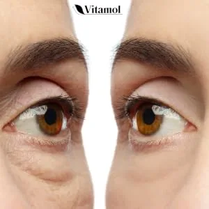 Vitamol Biosoft Eyes with stem cells 30 ml - Vitamol Biosoft oogcrème