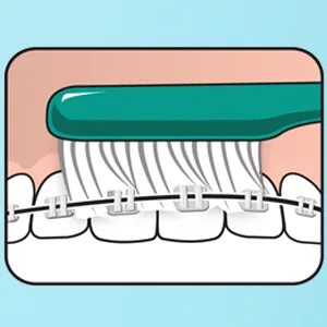 TEPE Implant Orthodontic Soft Toothbrush   Extra Narrow Brush Head Thin Neck 1Pk - product information 3