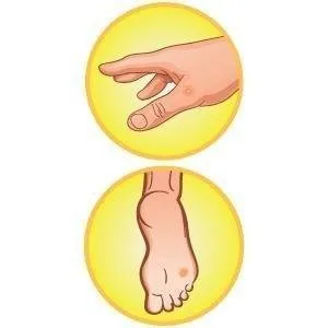 Dr. Scholl's Clear Away Wart Remover Plantar 24 ea - Warts