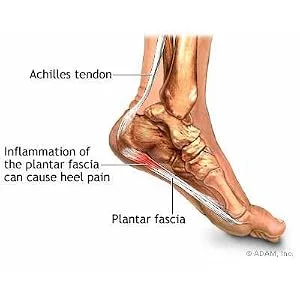 Cramer Dorsal Night Splint for Effective Relief from Plantar Fasciitis Pain Large - product information 3