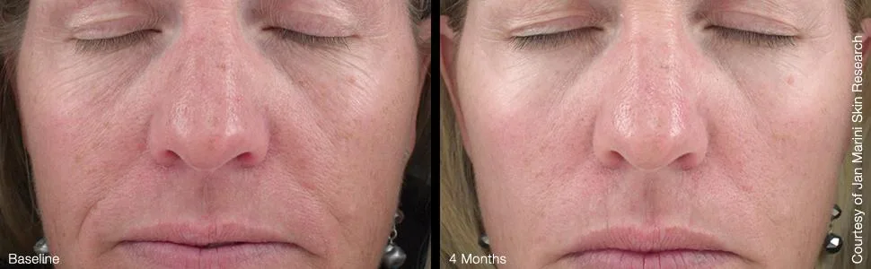 Age Intervention Retinol Plus I Retinol Cream- 1 oz - product information 1