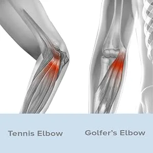 Bracoo Tennis-Golfer Elbow Strap  Quality Compression EVA Pad for Tendonitis  Muscle Strain Relief  EP40  One Size Gray - EE90