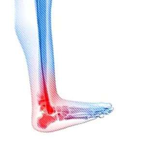 MUELLER Sport 4 Way Ankle Support  Large/X large - mueller