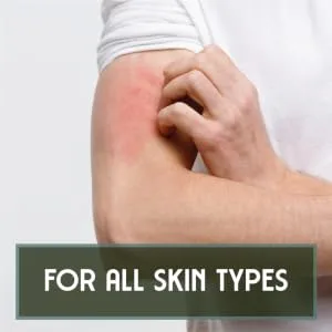 Total Body Wellness Naturulz 4 oz Cream - rash