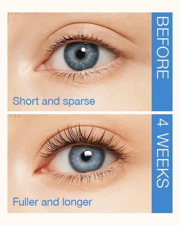 LASHVIEW Eyelash Growth Serum (0.17fl.oz / 5ml) - RECOMBINANT HUMANIZED COLLAGEN Premium Lash Enhancer for Longer Safe & Effective Formula for Visible Results in 3 Weeks - high-end eyelash growth serum