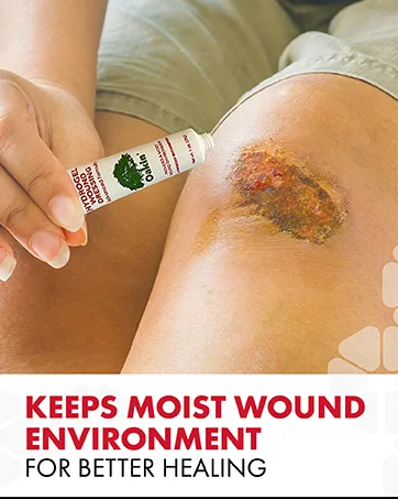 AMERIGEL - Bundle of 1oz Hydrogel Wound Dressing and 6oz Care Lotion - Keeps moist wound environment