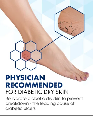 AMERIGEL - Bundle of 1oz Hydrogel Wound Dressing and 6oz Care Lotion - physician recommended
