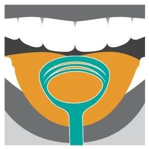 DenTek Comfort Fit Dental Guard Kit - product information 5