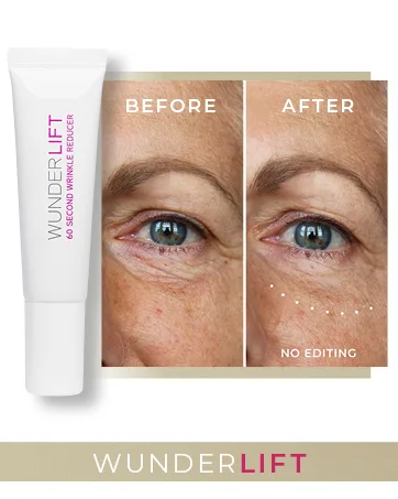 WUNDERBROW Wunderlift  60 Second Wrinkle Reducer  Under Eye Cream  Makeup  Vegan and Cruelty-Free (One size) - wunderlift before and after