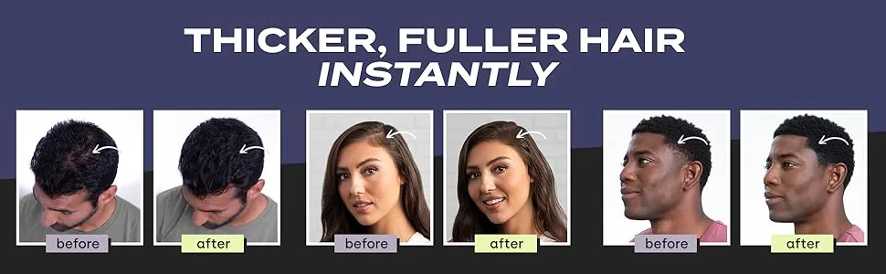 Toppik Colored Hair Thickener  Light Brown  5.1 OZ Medium Brown - Before and after