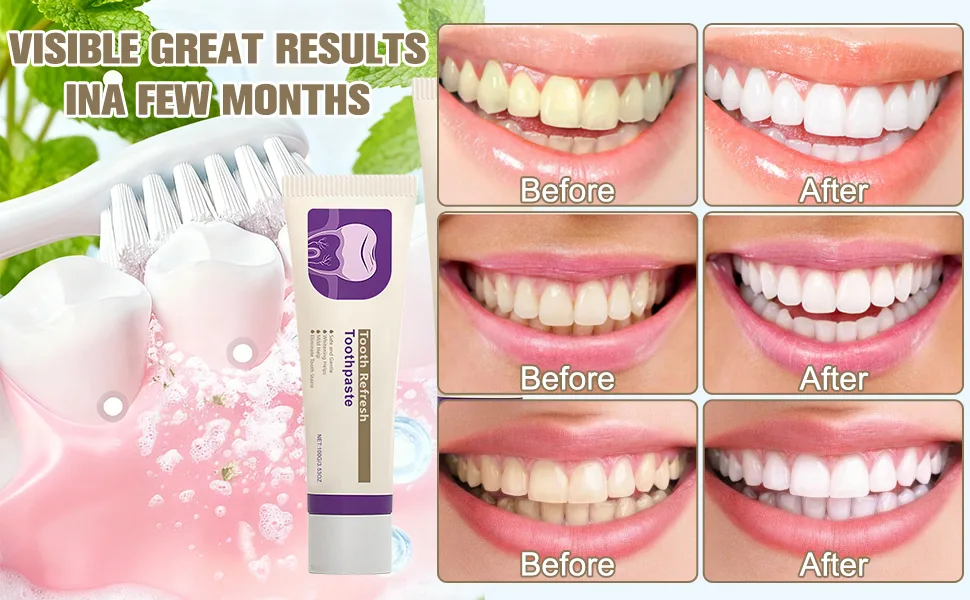 2Pcs Tooth Refresh Toothpaste Fresh Breath Toothpaste Natural Oral Care & Enamel Repair Helps Remove Coffee Tea & Wine Stain Deep Cleaning Care - product information 5