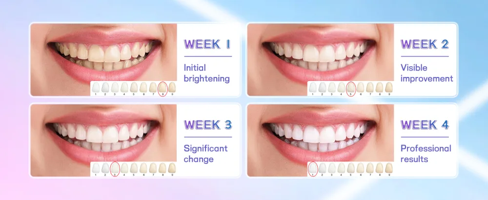 Professional Teeth Whitening Strips with Hydrogen Peroxide Mint Flavor Whitening Strips Residue-Free Gel Technology 28 Strips 14 Treatment for Sensitive Teeth - 28 Strips 14 Treatment for Sensitive Teeth