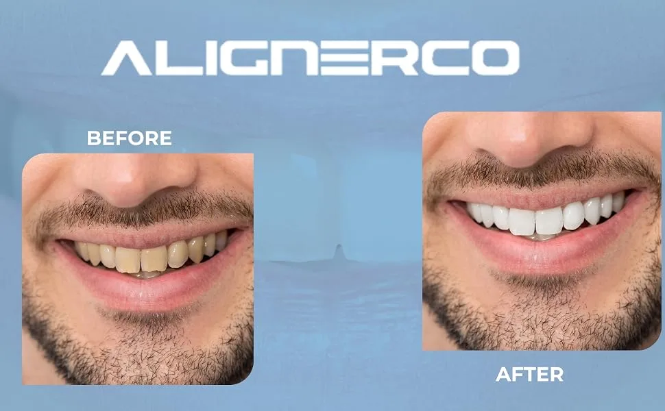 ALIGNERCO White Foam On-The-Go Clear Retainer Cleaner. Eliminates Bacteria Whitens Teeth & Fights Bad Breath - Aligner Cleaner