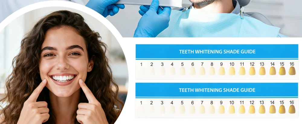 AUEAR 20 Pack Teeth Shade Guide Whitening Chart Tooth Color Cards White - tooth color card
