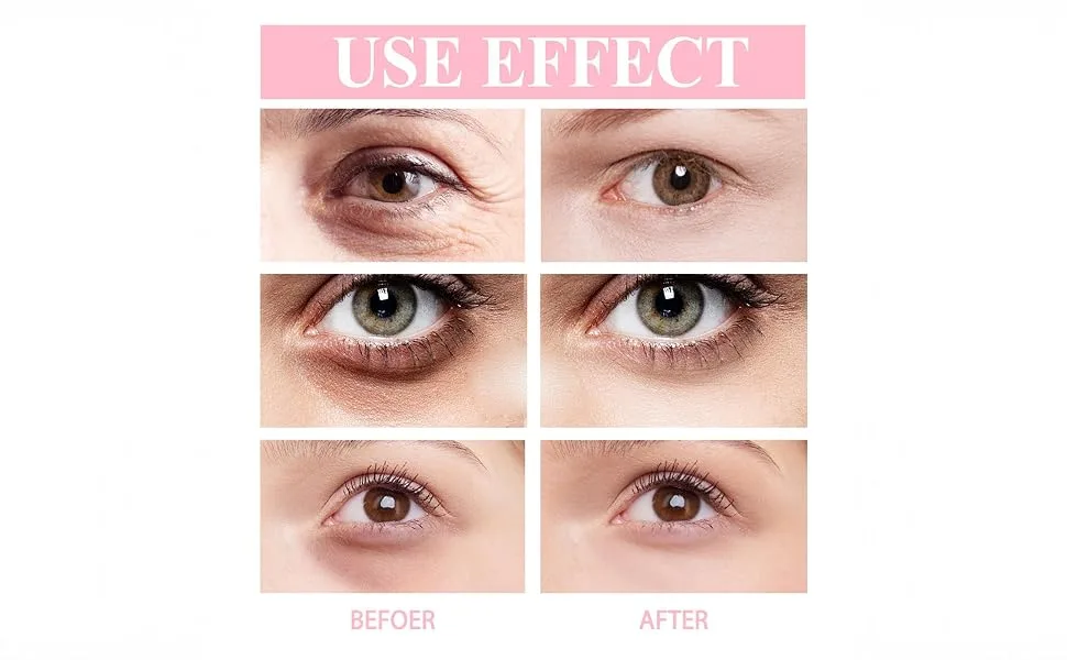 Retinol Eye Cream Stick with Deep Penetration Formula Anti-Aging Treatment for Dark Circles Fine Lines Wrinkles 3g - eye cream for dark circles,under eye cream for dark circles