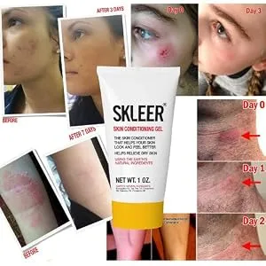 SKLEER Natural Skin Restoration Gel 1oz - 12 Pack - product information 4