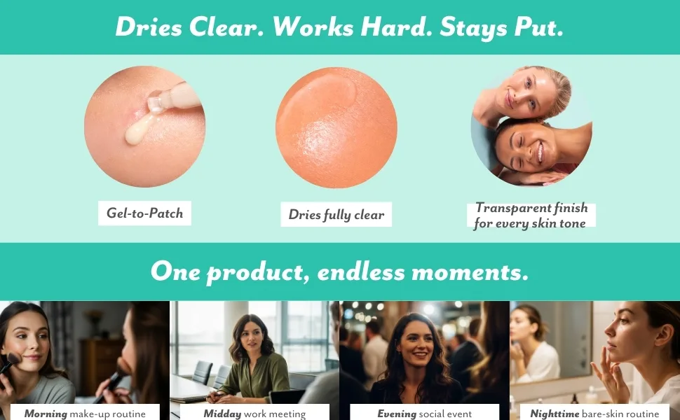 Patchology S.O.S. Overnight Acne Solution Gel-to-Patch Clarifying Liquid Patch 2.9% Sulfur 3% Niacinamide Dries Clear Fast Results Makeup Safe Pregnancy Safe Face & Body Use - Mussum Ipsum