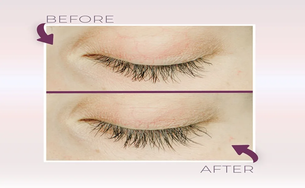 Blinc Lash & Brow Enhancer Serum 4.50 ml / 0.15 fl oz - Before and After