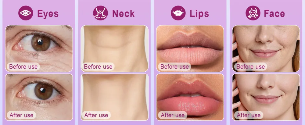 Akeeronn 2PCS Calcium Multi Balm Calcium Volume Multi Balm Anti-Aging Wrinkle Core Stick Collagen Moisturing Stick for Moisturizing and Firming Eyes Neck and Face 9g - The comparison of eyes, neck, lips, and face