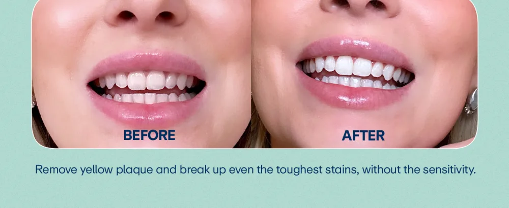 Lumineux Whitening Starter Set Peroxide Free - Enamel Safe for Whiter Teeth Includes 7 Whitening Treatments & 2 Pack Whitening Toothpaste, Fluoride Free & Dentist Formulated Starter Pack - new White