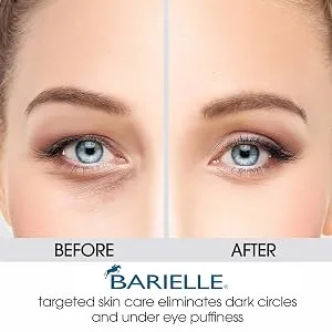 BARIELLE Vitamin C Moisturizing Balm Stick for Deeply Moisturized Skin - Facial Treatment Stick (4-PACK) - Barielle Chamomile Before After