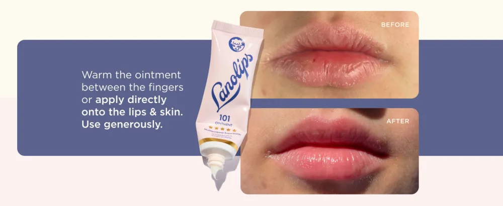 Lanolips Rose Gold 101 Ointment - Natural Lanolin Moisturizer with Blush Color Tints for Lips + Cheeks - Long Lasting Hydrating Balm + Tint - Clean Cruelty-Free (9g) - Application