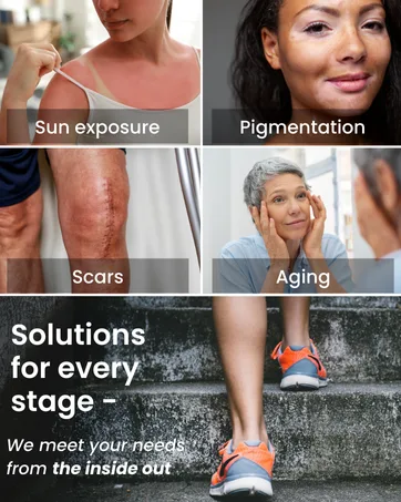 GlocalCare Depigma Support Reduction of Hyperpigmentation Melasma & Dark Spots with Glutathione Polypodium Leucotomos Grape Seed & Marigold Extract - product information 6
