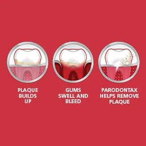 Parodontax Whitening Toothpaste for Bleeding Gums  Teeth Whitening and Gingivitis Treatment - 3.4 Ounces - parodontax MOA