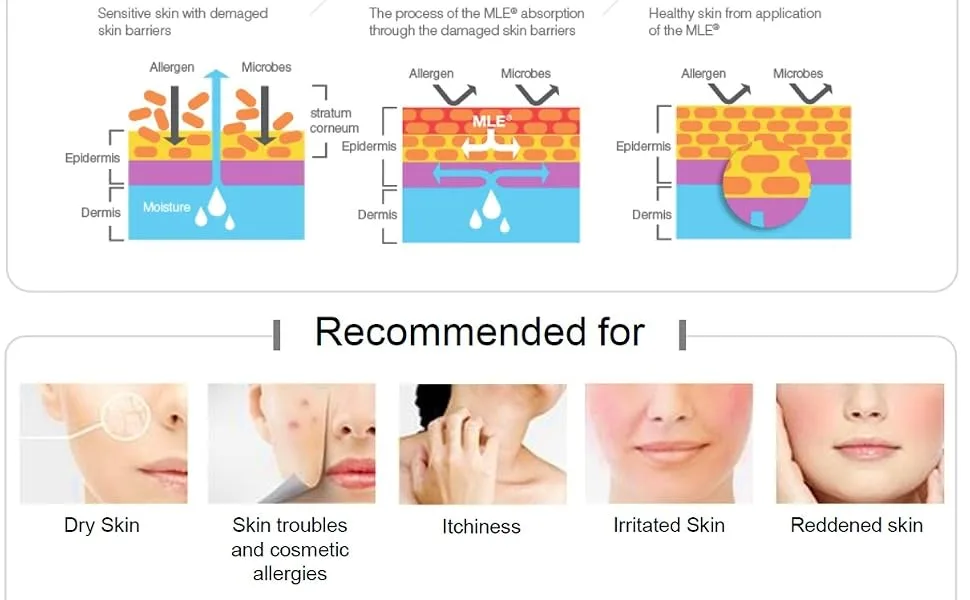 ZEROID Richenic Cream Urea 5% Intensive Care for Severe Dry & Disordered Skin (60 mL) - Zeroid MLE