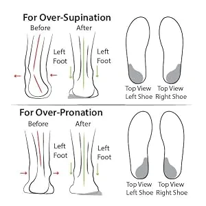 Heel Wedge for Over-Supination/Over-Pronation Re-Usable Adhesive Soul Insole - supination pronation heel inserts shoe insoles varus valgus 1/4 achilles pads men women