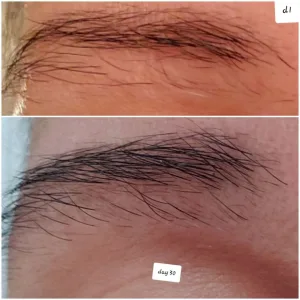 BeautyGARDE Damage Control Lash + Brow Fortifier  Eyelash & Brow Growth Enhancer & Serum for Long  Luscious Lashes and Eyebrows - brow