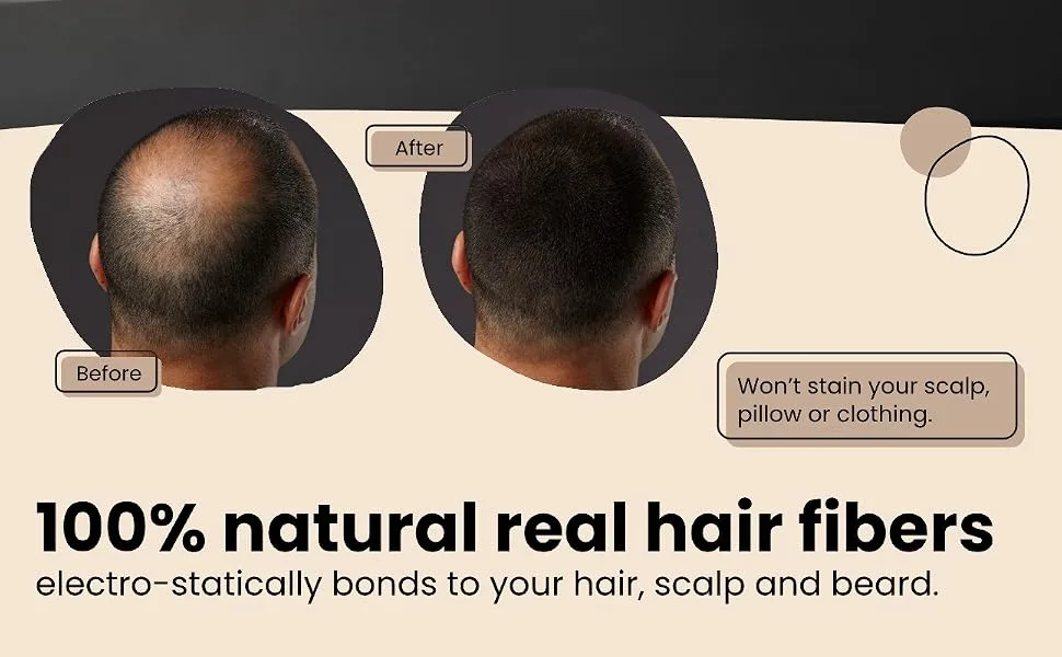Hair Illusion Hairline Optimizer - before after with Sal