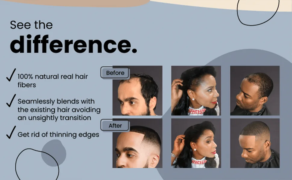 Hair Illusion Hairline Optimizer - hair illusion