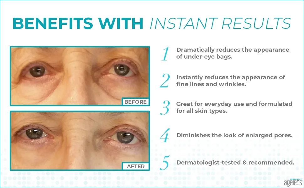 Instantly Ageless - Facelift in a Box (25 vials) and Moisture Lift (1.7 oz) - results