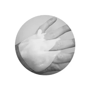 Burnshield Mini Burn Kit with Burn Dressing  Burn Gel and Securing Bandage - hand burn dressing