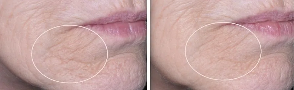 Biopelle Stem Cell Cream Moisturizer - Stem Cell Face Cream Before & After